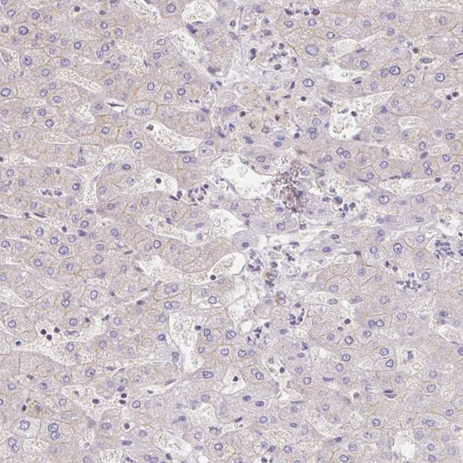 RAB9B Antibody in Immunohistochemistry (IHC)