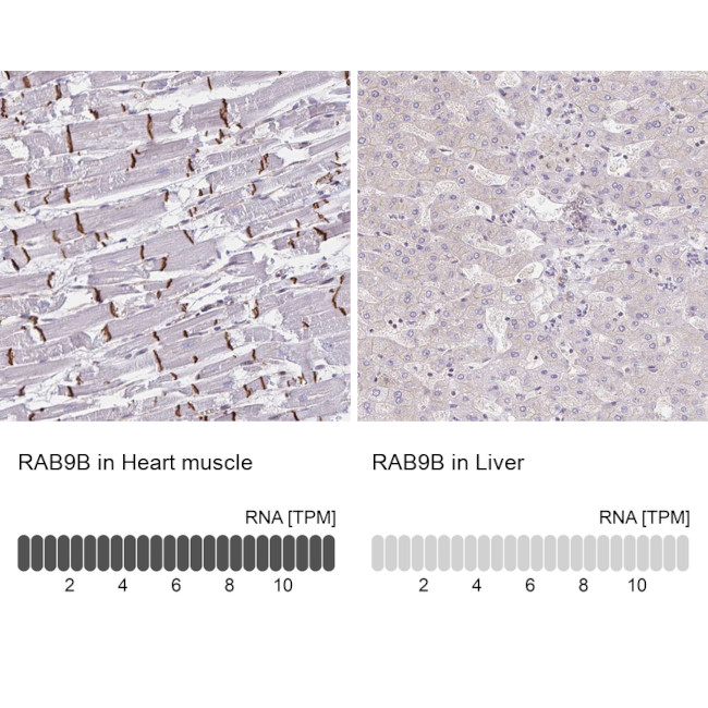 RAB9B Antibody