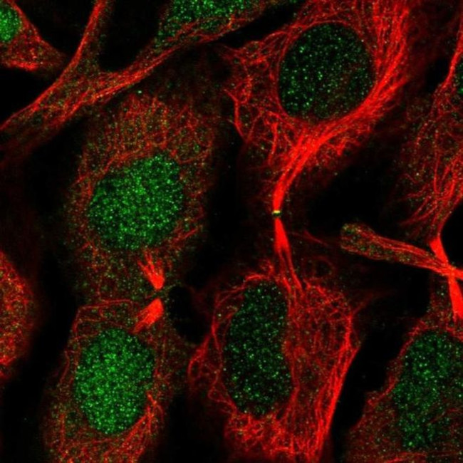 CHMP1B Antibody in Immunocytochemistry (ICC/IF)