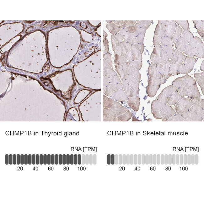 CHMP1B Antibody in Immunohistochemistry (IHC)