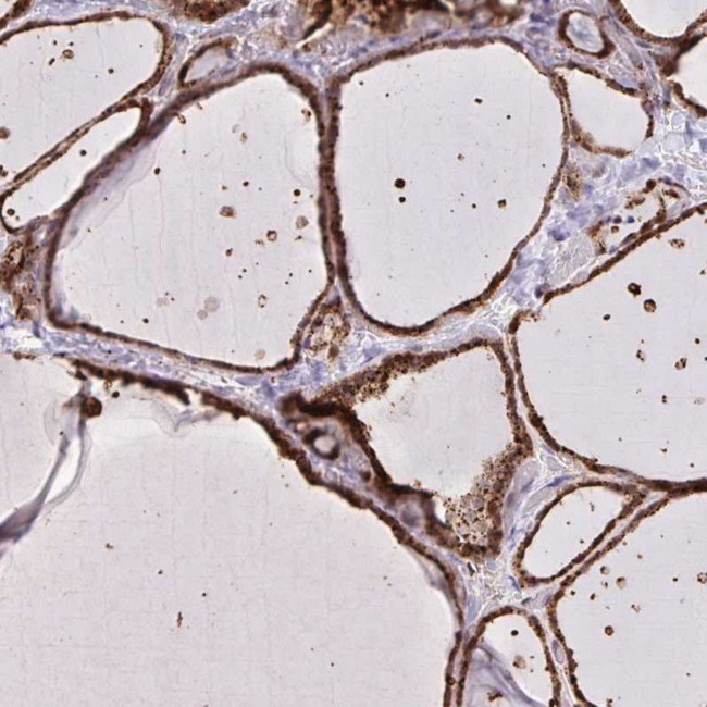 CHMP1B Antibody in Immunohistochemistry (IHC)