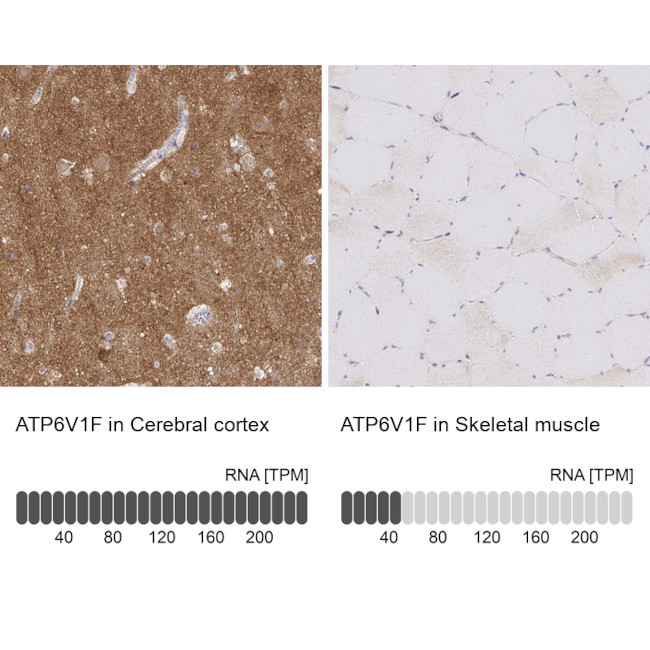 ATP6V1F Antibody in Immunohistochemistry (IHC)