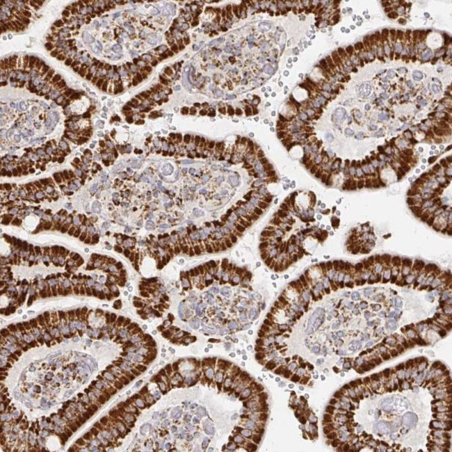 STOML2 Antibody in Immunohistochemistry (IHC)