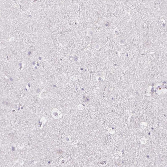 FDX1 Antibody in Immunohistochemistry (IHC)