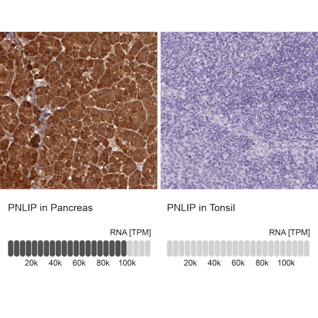 PNLIP Antibody in Immunohistochemistry (IHC)
