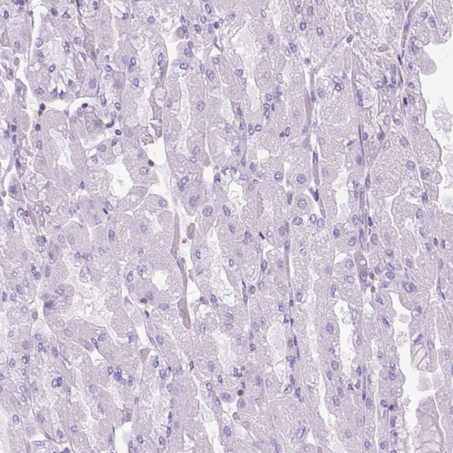 S100A2 Antibody in Immunohistochemistry (IHC)