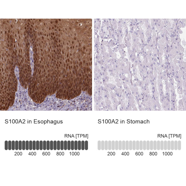 S100A2 Antibody