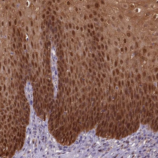 S100A2 Antibody in Immunohistochemistry (IHC)