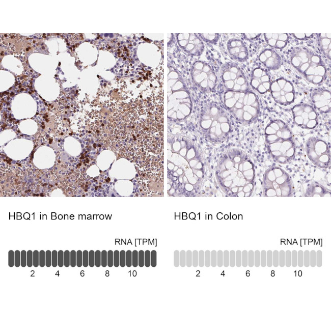 HBQ1 Antibody in Immunohistochemistry (IHC)