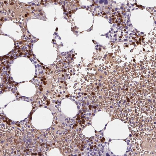 HBQ1 Antibody in Immunohistochemistry (IHC)