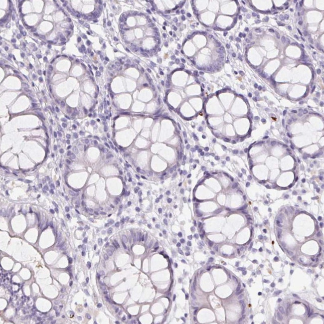 HBQ1 Antibody in Immunohistochemistry (IHC)