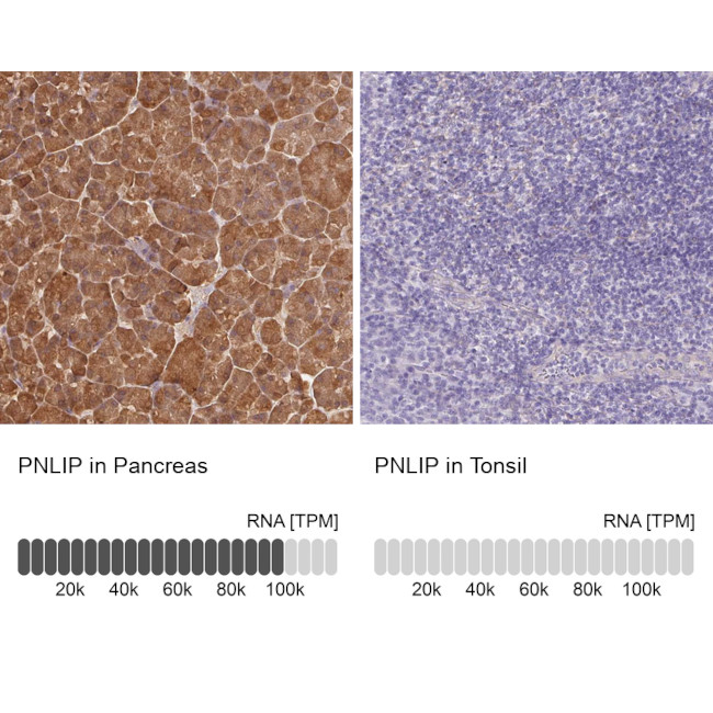 PNLIP Antibody in Immunohistochemistry (IHC)