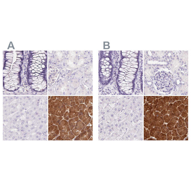 PNLIP Antibody in Immunohistochemistry (IHC)