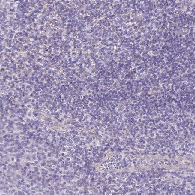 PNLIP Antibody in Immunohistochemistry (IHC)