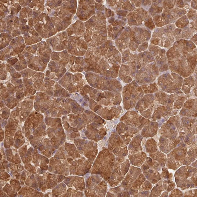 PNLIP Antibody in Immunohistochemistry (IHC)