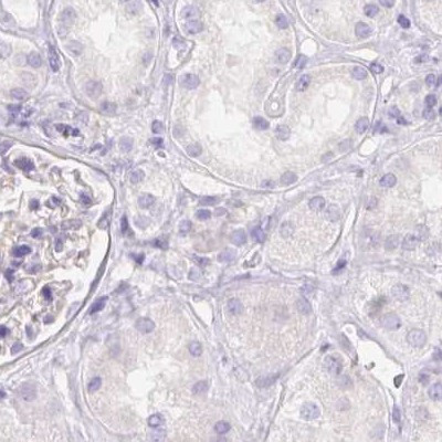 PNLIP Antibody in Immunohistochemistry (IHC)