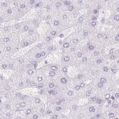 PNLIP Antibody in Immunohistochemistry (IHC)