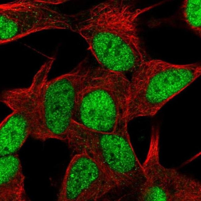 ZNF781 Antibody in Immunocytochemistry (ICC/IF)