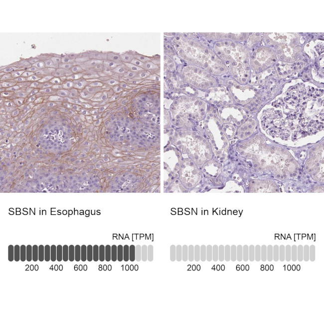 SBSN Antibody in Immunohistochemistry (IHC)