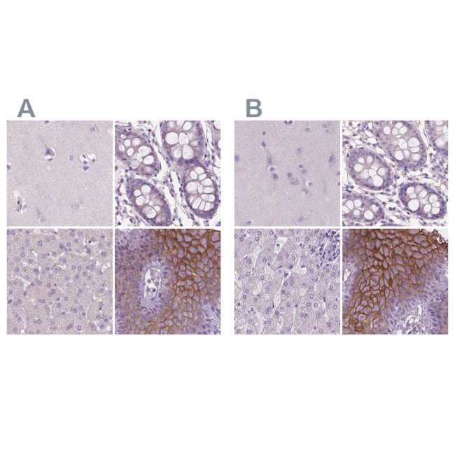 SBSN Antibody in Immunohistochemistry (IHC)