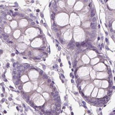 SBSN Antibody in Immunohistochemistry (IHC)