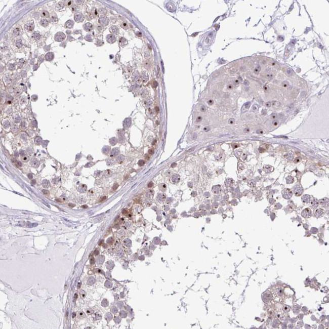 RSL24D1 Antibody in Immunohistochemistry (IHC)