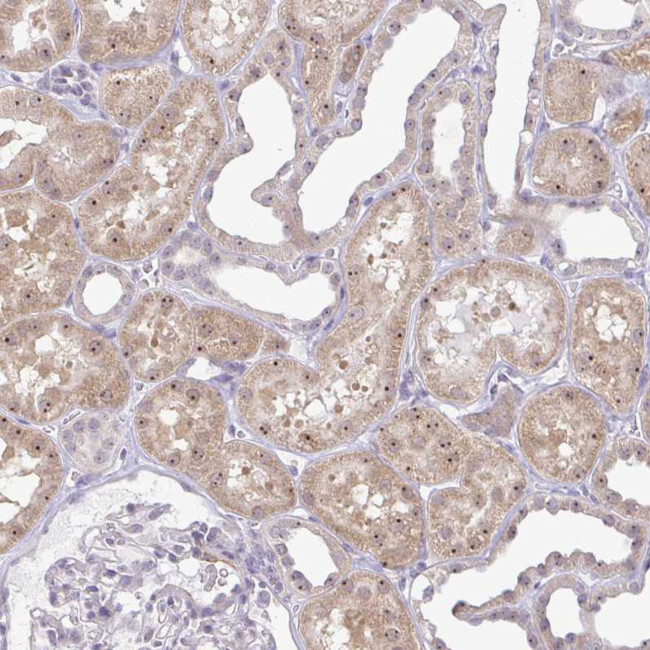 RSL24D1 Antibody in Immunohistochemistry (IHC)