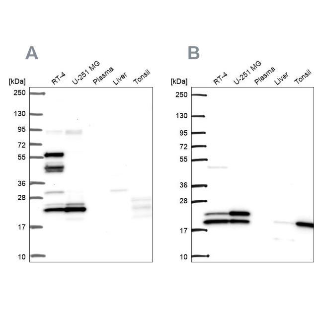 RSL24D1 Antibody in Western Blot (WB)