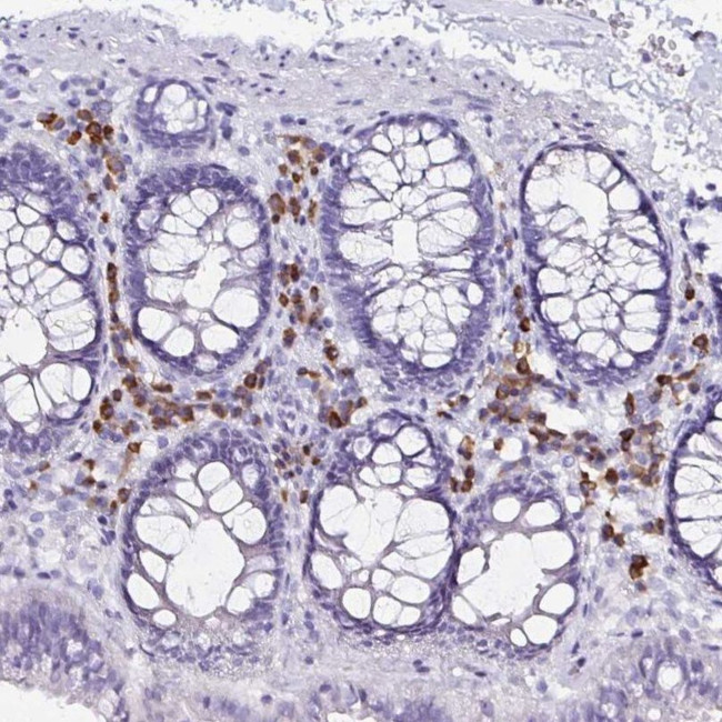 FNTB Antibody in Immunohistochemistry (IHC)