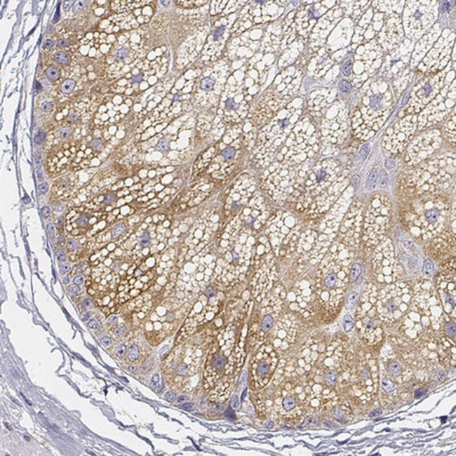 AWAT2 Antibody in Immunohistochemistry (IHC)