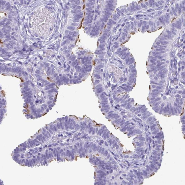 ODF3B Antibody in Immunohistochemistry (IHC)