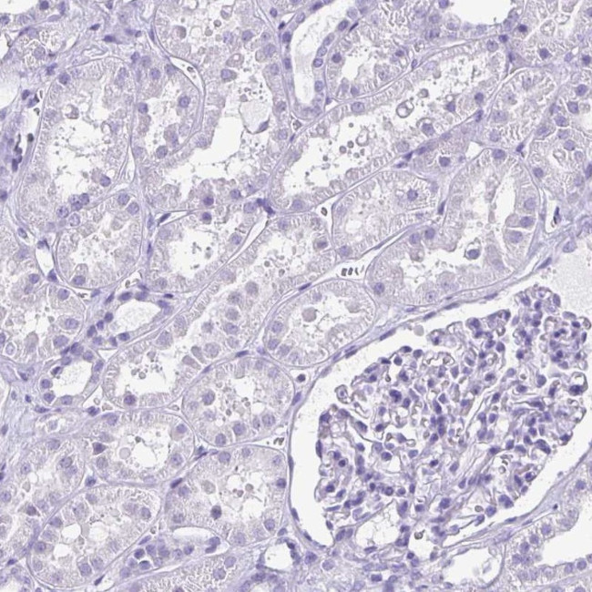 ODF3B Antibody in Immunohistochemistry (IHC)