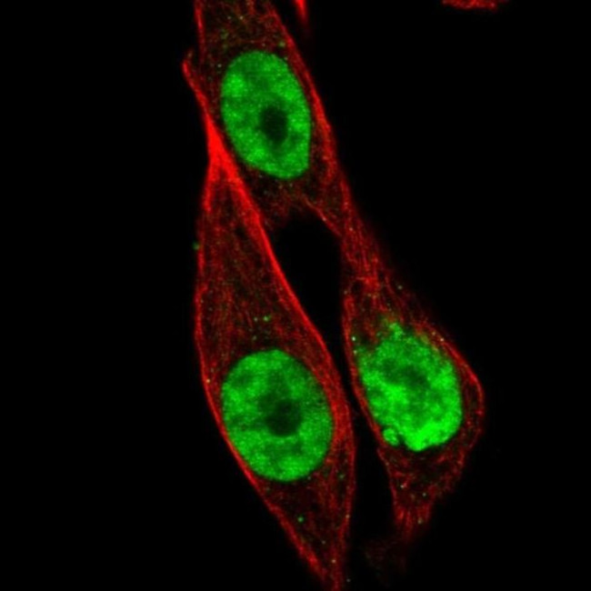 HOXB13 Antibody in Immunocytochemistry (ICC/IF)