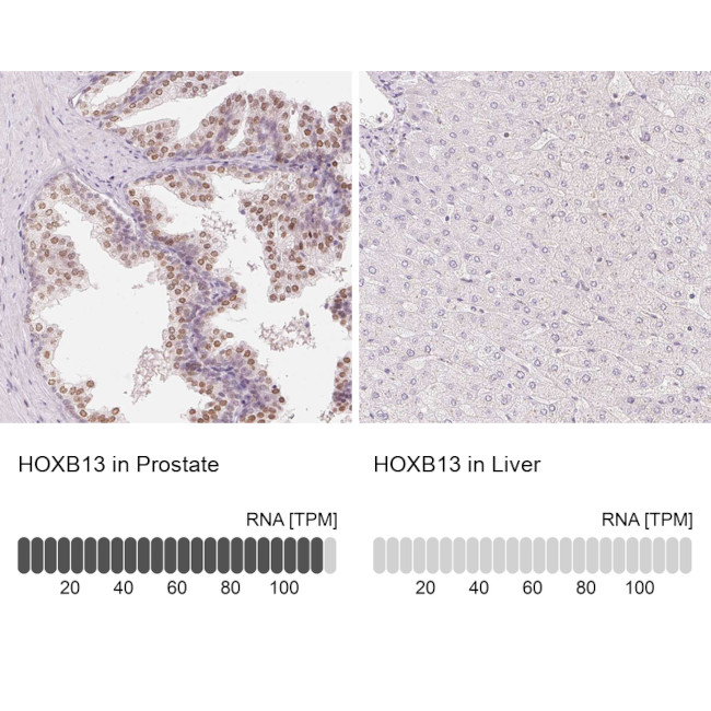 HOXB13 Antibody in Immunohistochemistry (IHC)