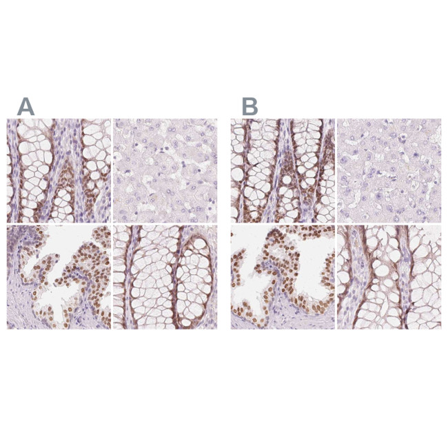 HOXB13 Antibody in Immunohistochemistry (IHC)