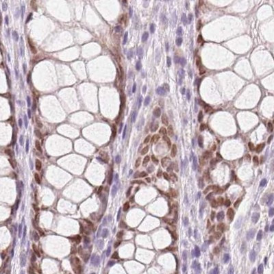 HOXB13 Antibody in Immunohistochemistry (IHC)