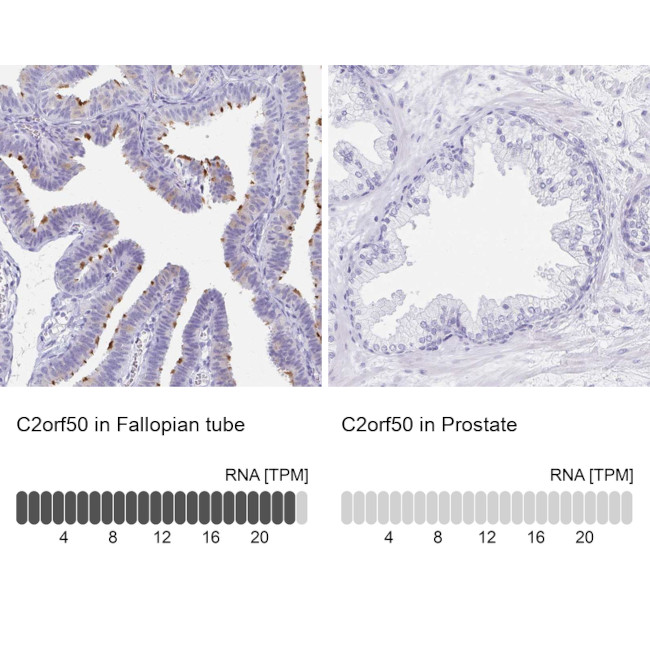 C2orf50 Antibody in Immunohistochemistry (IHC)