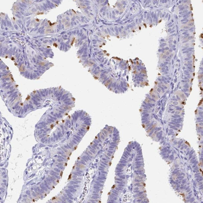 C2orf50 Antibody in Immunohistochemistry (IHC)