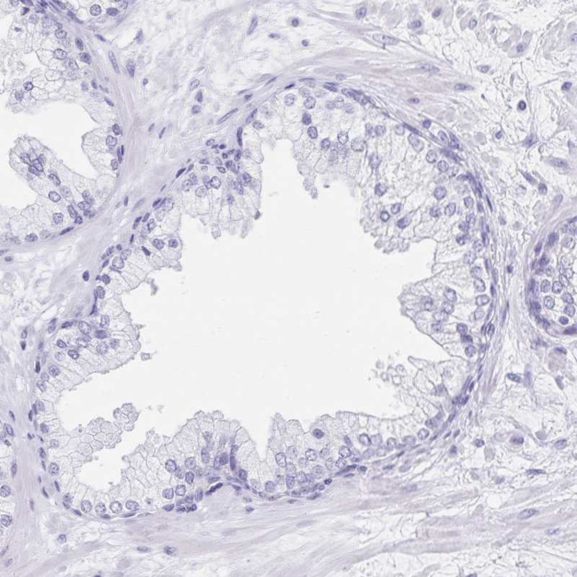 C2orf50 Antibody in Immunohistochemistry (IHC)