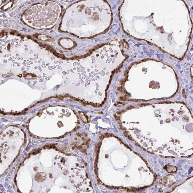 CHMP1B Antibody in Immunohistochemistry (IHC)