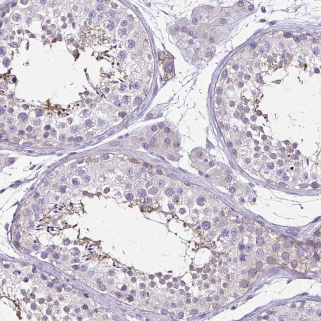 ULBP3 Antibody in Immunohistochemistry (IHC)