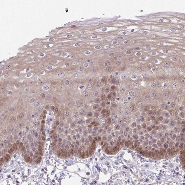 TAX1BP3 Antibody in Immunohistochemistry (IHC)