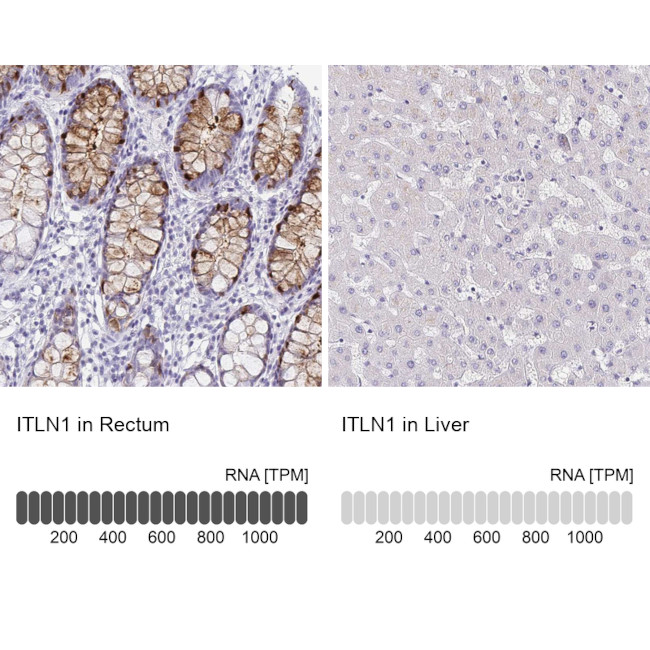 ITLN1 Antibody in Immunohistochemistry (IHC)