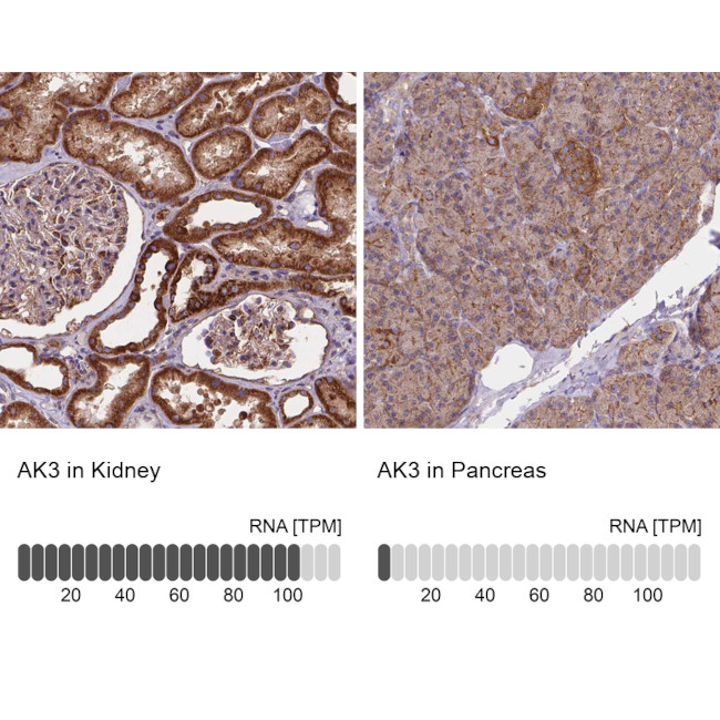 Adenylate Kinase 3 Antibody in Immunohistochemistry (IHC)