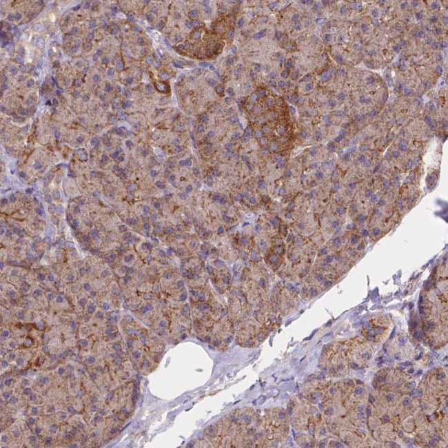 Adenylate Kinase 3 Antibody in Immunohistochemistry (IHC)