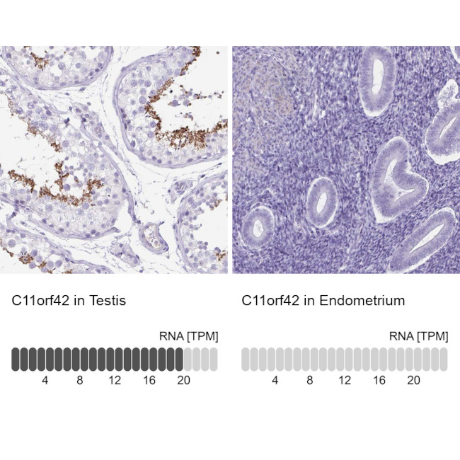 C11orf42 Antibody