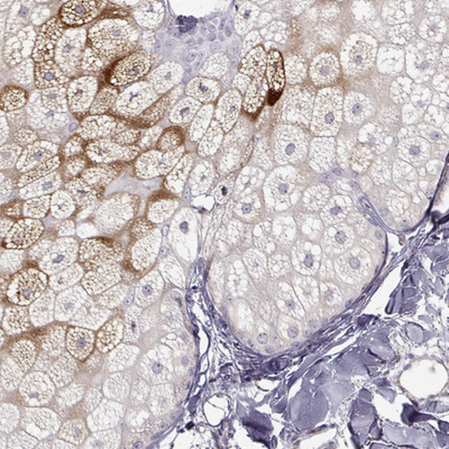 AWAT1 Antibody in Immunohistochemistry (IHC)