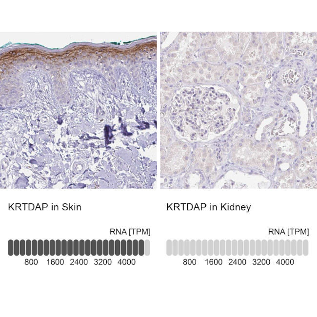 KRTDAP Antibody in Immunohistochemistry (IHC)