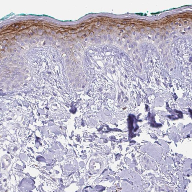 KRTDAP Antibody in Immunohistochemistry (IHC)