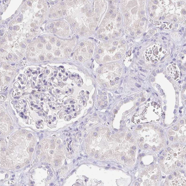 KRTDAP Antibody in Immunohistochemistry (IHC)